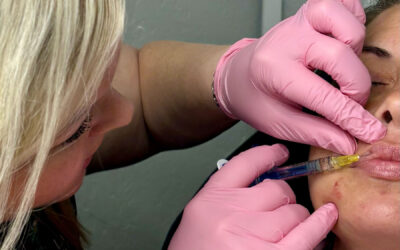 Dermal Fillers